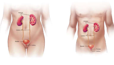 Infectie urinara - simptome, cauze si tratament